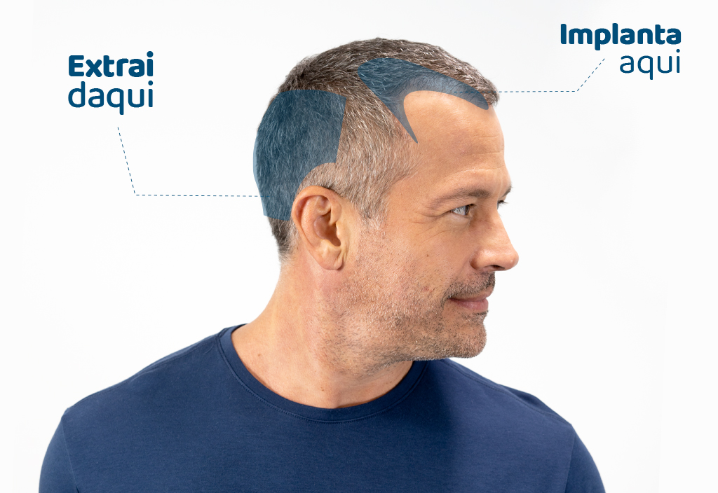 TOP 10 – DÚVIDAS MAIS CABELLO - Mais Cabello